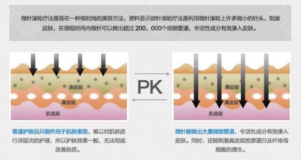 黄金微针、微针和水光针有什么区别？整形专家告诉你该怎么抗衰老(水光黃金射頻)