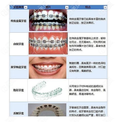 2023年12月国内正畸费用表出炉_各品牌（金属/隐形）费用一览(矯正隱形費用)