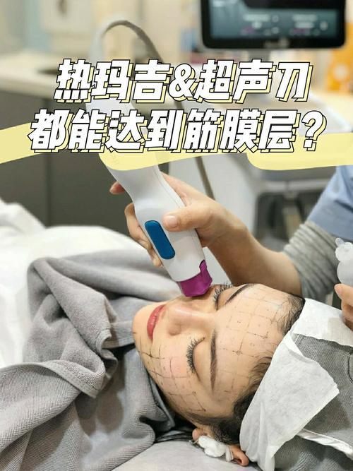 超声刀多久做一次？超声刀做完会反弹吗？(超聲膠原蛋白做完)