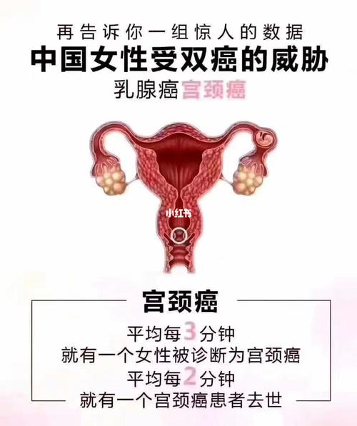 女性为什么一定要做私密保养？(保養私密女性)