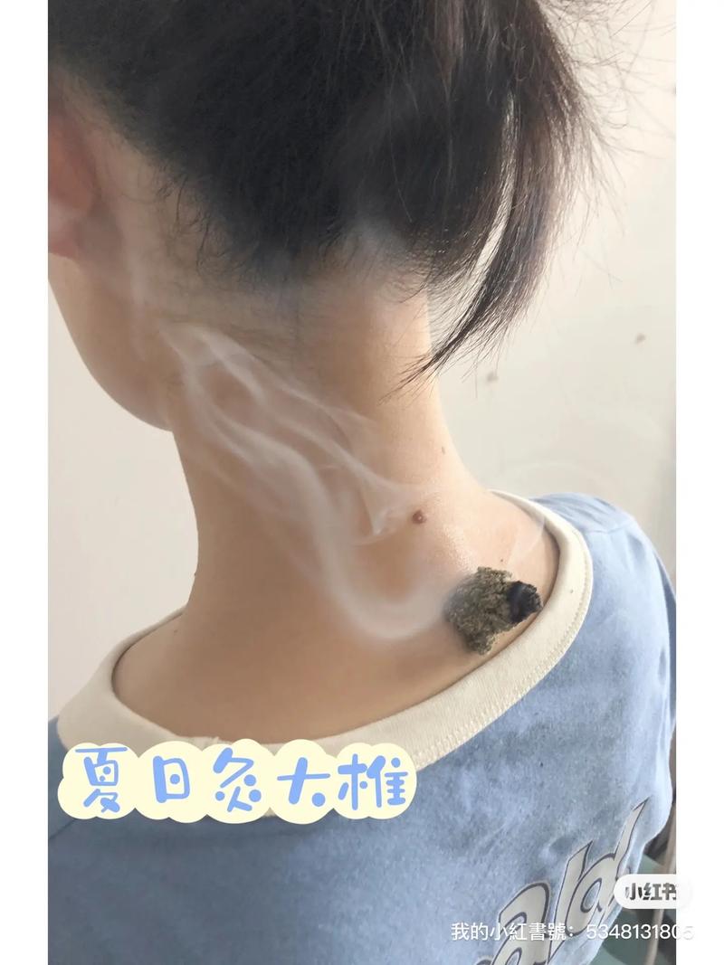 老人美容院做艾灸_试一试后_结果惨不忍睹(艾灸美容院阿姨)