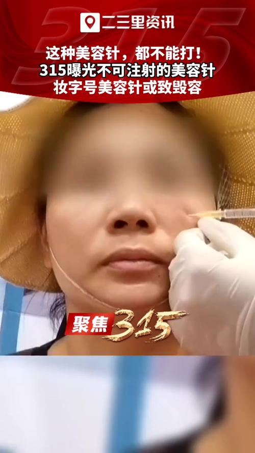 妆字号美容针被央视315曝光_行业还有哪些“隐秘”问题？(化妝品熒光量子)