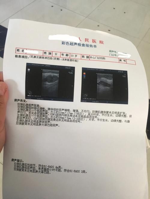 25岁女孩体检发现条状乳腺结节_在广东省人民医院接受乳腺刀“无疤痕”切除(乳腺結節手術)