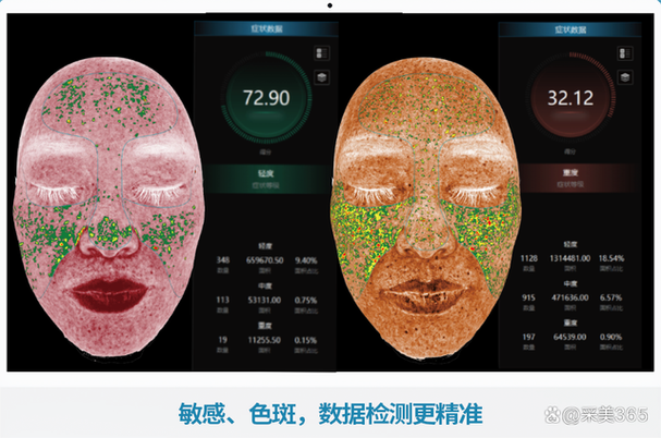 肌肤影像分析仪制定个性化护肤方案(肌膚分析分析儀)