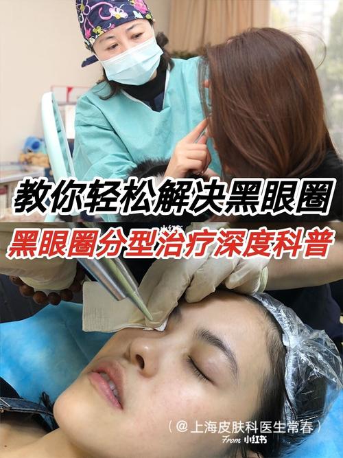 南京市第二医院整形美容外科_给“黑眼圈”开门诊(黑眼圈色素皮膚)