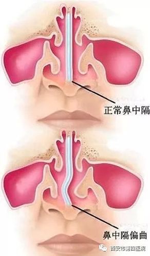 【患者福音】强强联手 让你重塑美丽(患者讓你頭頸)