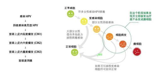 辟谣：这种病距离宫颈癌只有一步之遥？信这个你就被坑了(宮頸癌宮頸醫生)