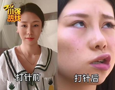 假美容院打“瘦脸针”、刚办卡就关门……相城人可不能再掉这些“坑”里了(美容院可不瘦臉)