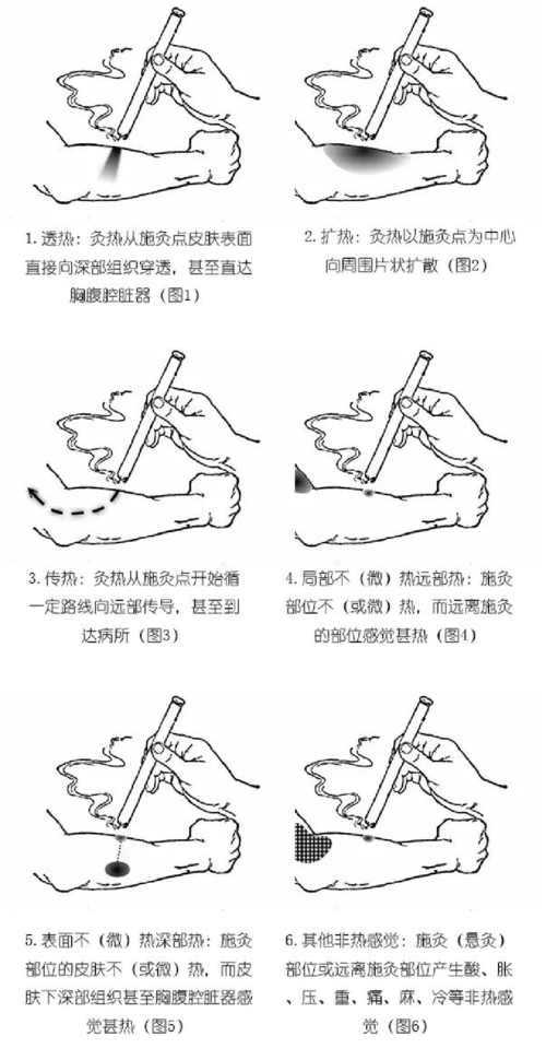 赣州新增16家医疗机构纳入热敏灸医保支付范围(熱敏中醫藥納入)