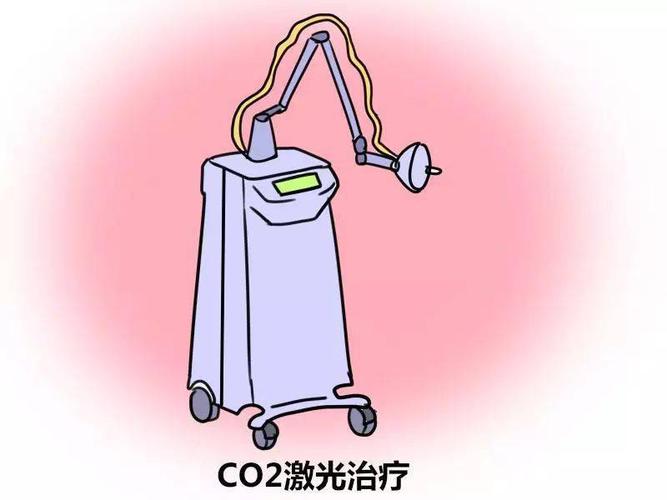 来自妇科的神秘之光——CO2激光(激光病變宮頸)