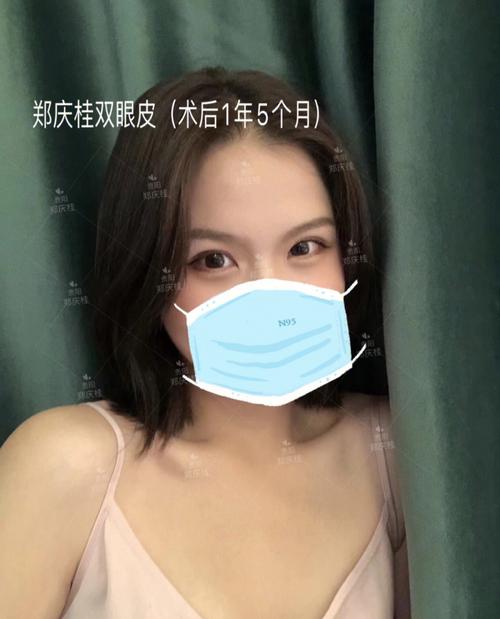 刚做完双眼皮_整形医院又让“削骨”_贵阳女子交完钱就后悔了…(雙眼皮又讓錢就)