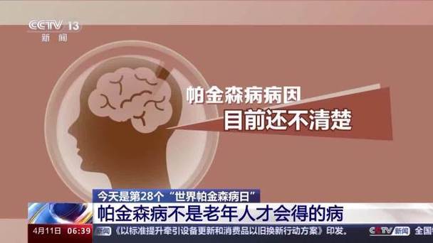 表现不只手抖、并非“正常老化” 关于帕金森病的更多了解(帕金森病癥狀帕金森)