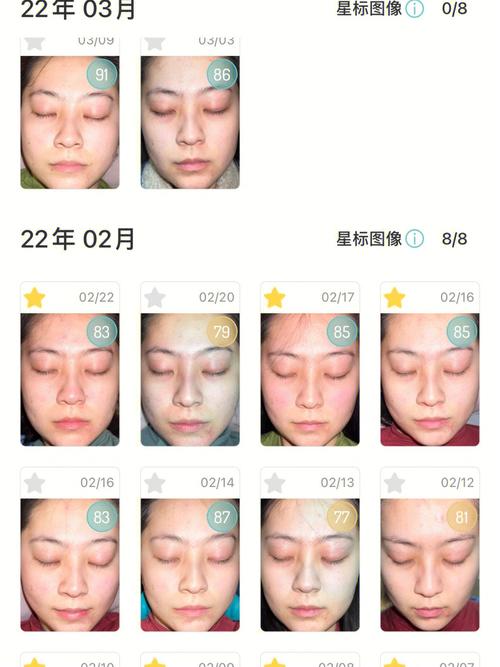 春节不回家 ?整形美容“扎堆忙”_专家提醒：需选择正规医院并重视术后护理(吸脂整形手術)