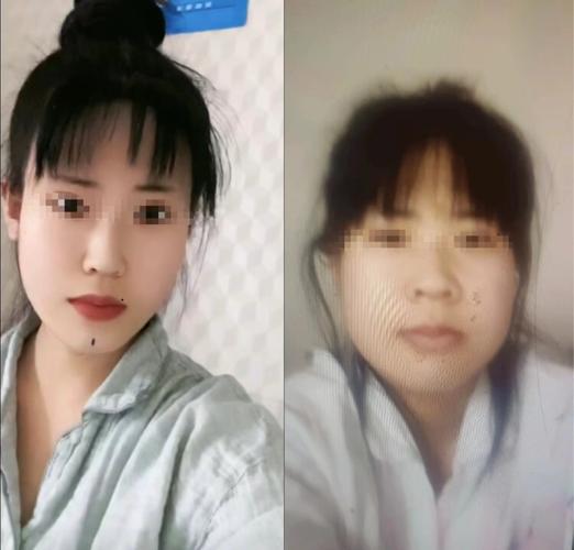 花费近12万做医美_如今的她……(李女士花費肚子)