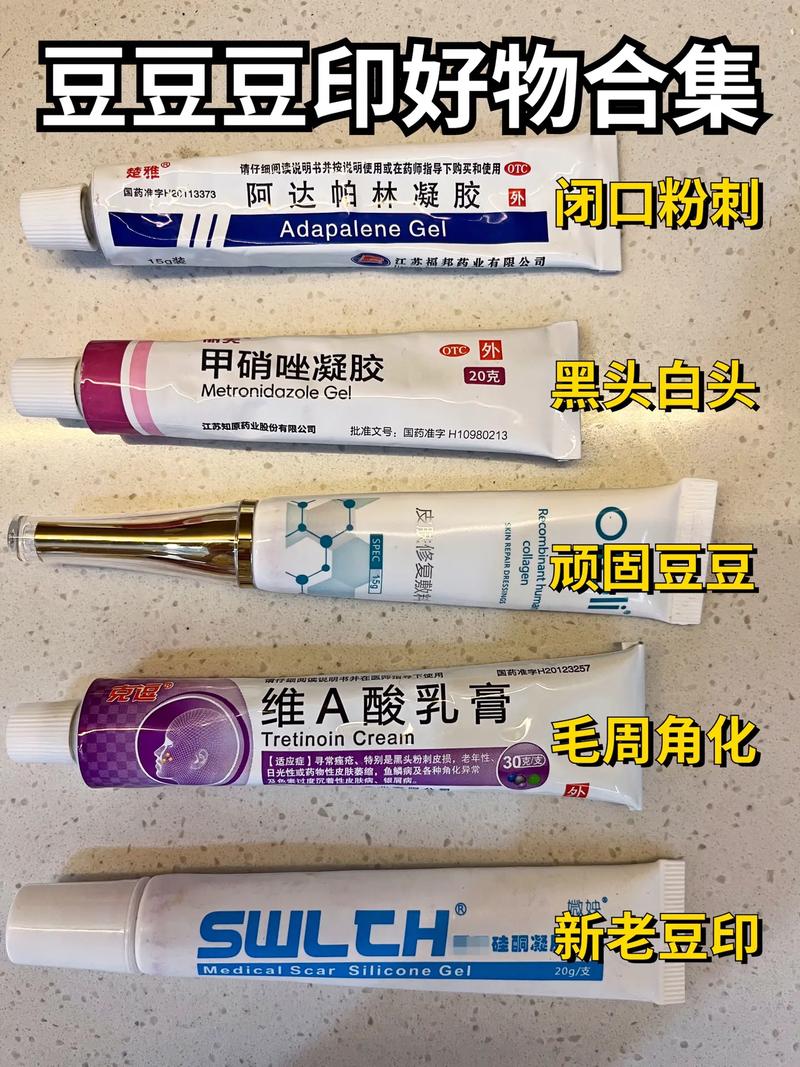 战“痘”须知_到药店买这6种小药膏平价有效！(藥膏平價痘痘)