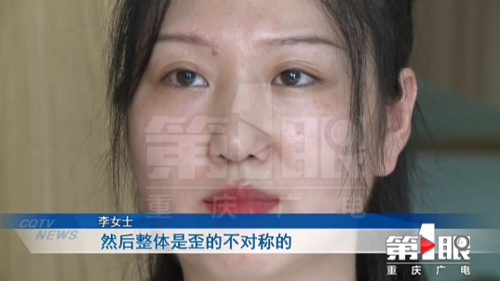 花费23000元在美伊尔做整形_女子：鼻子“老遭罪了”(李女士鼻子遭罪)