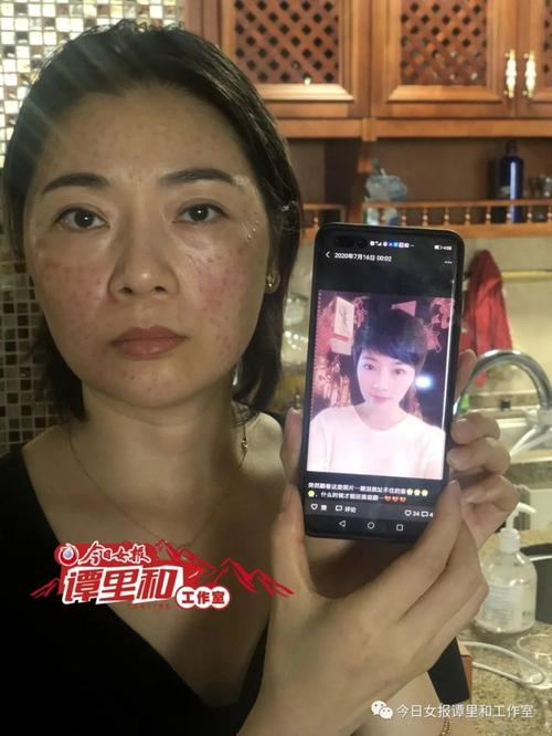 岳阳一爱美女士打水光针把脸“打坏”了_非法行医者已被拘留(水光犯罪嫌疑人行醫)