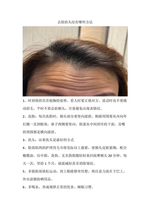 4个手术方法 助你去除抬头纹(抬頭紋除皺去除)