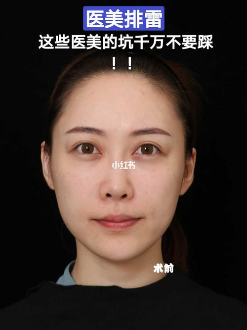 一年4万起医美事故 毕业就去整容别掉进这些坑……(整容行業整形)