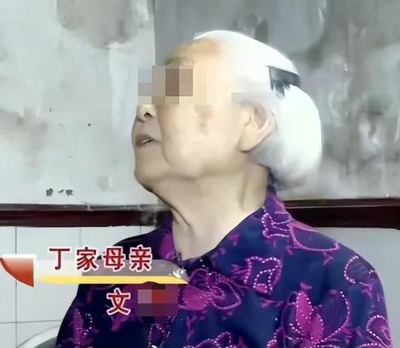 为迎孙子出生婆婆做美容_花3万8脸烂出坑眼闭不上_老伴要离婚(孫子老伴不上)