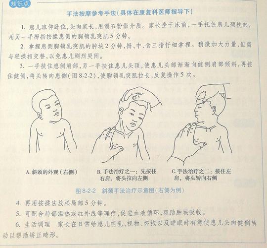 揉捏牵转法治疗小儿肌性斜颈技术(患兒斜頸牽拉)