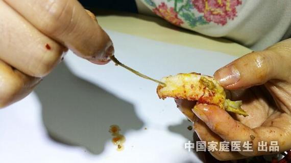 6种被“吹上天”的食物_醒醒吧_并没有想象的那么神奇(食物蝦皮傢庭醫生)