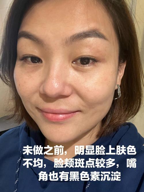 超光子比光子高大上？优势到底在哪里？这银子值不值得多花？(光子值不值得皮膚)