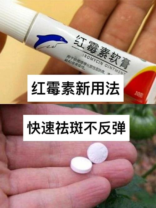 红霉素软膏涂脸_真的能“祛斑”吗？(紅黴素軟膏祛斑)