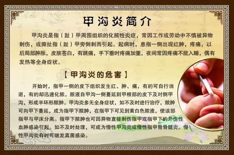 养生不注意_当心染上不干净的病！做这些保健项目可千万要当心(疾病真菌修腳)