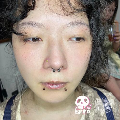 警惕！爱美女子做鼻子整形后总鼻塞、流鼻血_竟是这样造成的(鼻中隔穿孔李小姐)