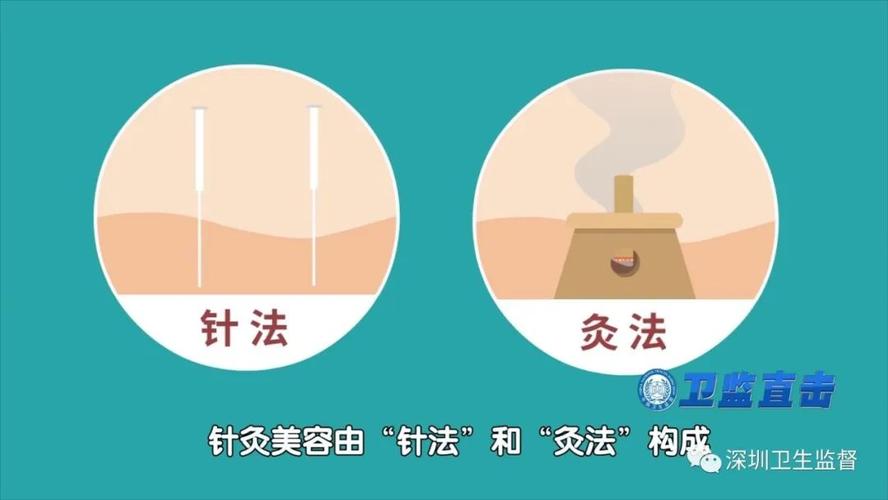 刮痧、针灸也能美容？去哪儿做靠谱？速速了解(刮痧針灸美容)