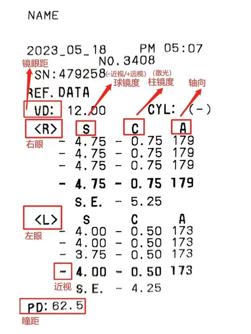 医学验光配镜中心(它是老花眼度數)