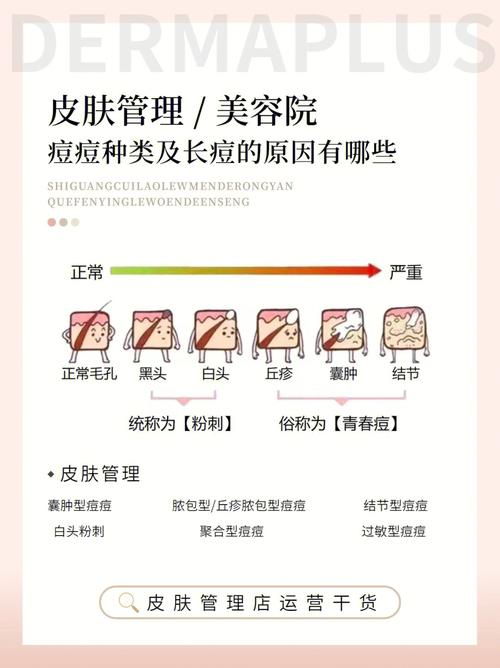 线上美容私教（29） 【痘痘篇：4.案例分享/3(痘痘囊腫線上)