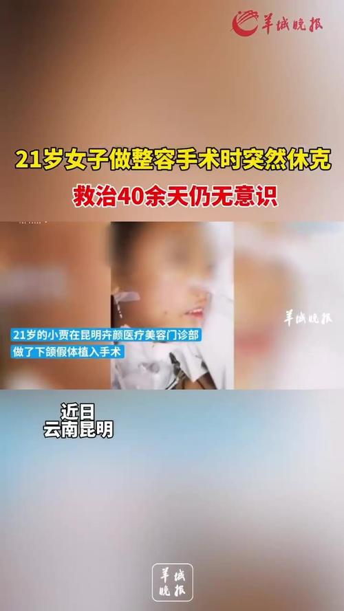 昆明21岁女子整容过程中突然休克_救治40余天仍无意识……(休克救治整容)