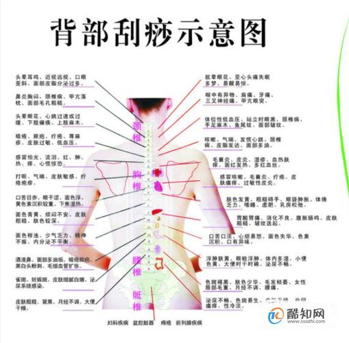 艾灸、刮痧、拔罐_在家里怎么做？中医专家教你诀窍(艾灸刮痧皮膚)