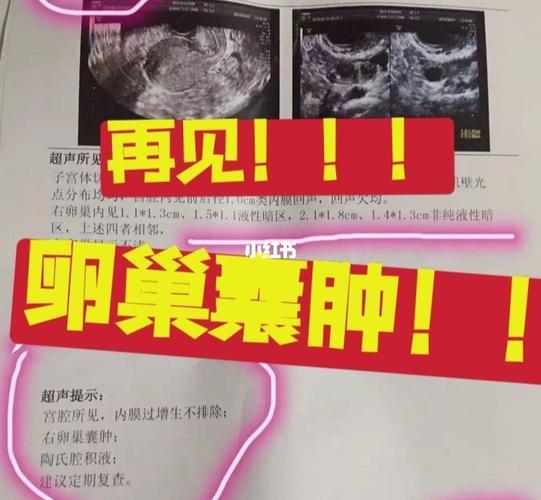 女子急诊发现卵巢囊肿破裂！揭秘美容院爆款“卵巢保养”！(卵巢美容院保養)