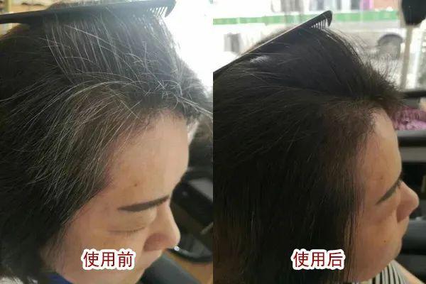 女子花4万“白发转黑”_结果治疗手段就是拔白头发_一个疗程收费7800元！美容院回应(療程美容院白發)