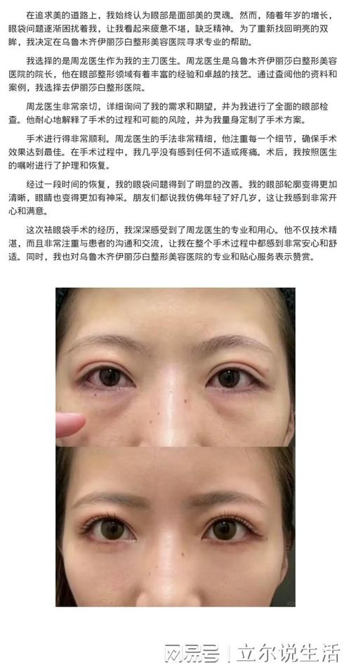 乌鲁木齐女子在私人工作室祛眼袋_2厘米长美容针掉进眼眶(眼袋手術美容)