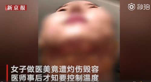 益阳女子整形手术途中被医生强加项目_惨遭毁容！多家医美机构被调查(多傢強加毀容)