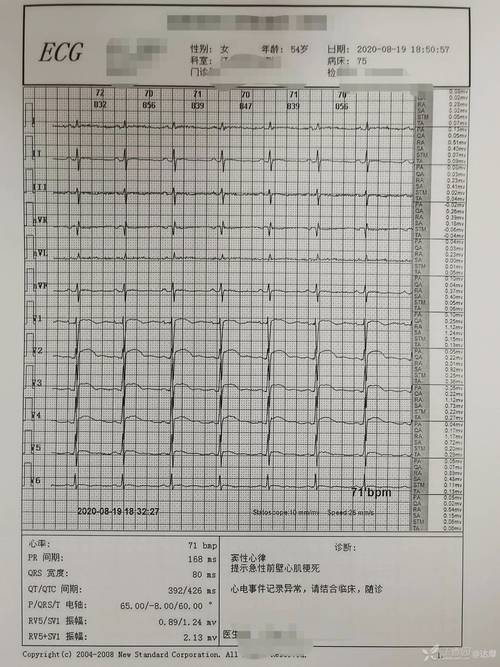 \"急疯了！\"被连挂5次_医生坚持电话“轰炸”_最终抢回一条命(心電圖轟炸師傅)