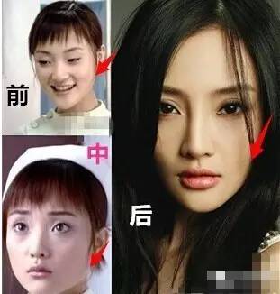 为什么有人不要命_也要美容(整容我說她說)