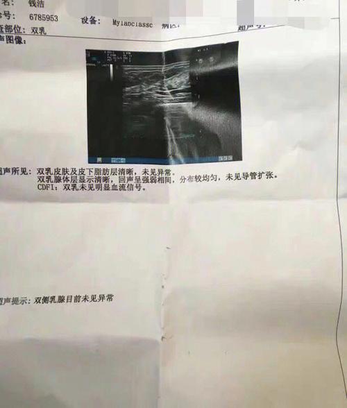 那些体检查出「乳腺结节」的女性_是时候点开这篇文章了(結節乳腺腫塊)