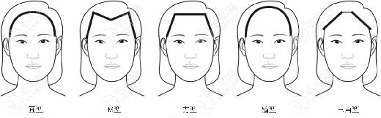 你的脸型适合哪种发际线形态？这套方法很实用(發際臉型線形)