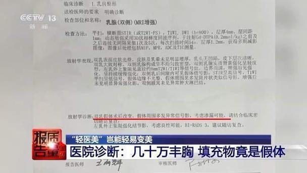 震惊！女子隆胸风波揭露填充物内含动物源性材料！(動物相關部門黑猩猩)