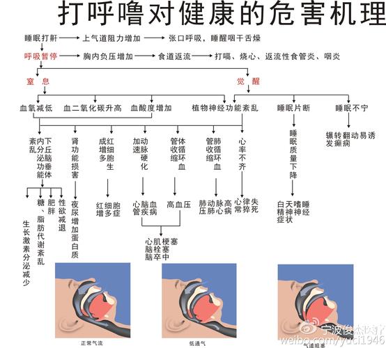 一文讲解呼吸暂停都有哪些危害(打呼嚕睡眠呼吸)