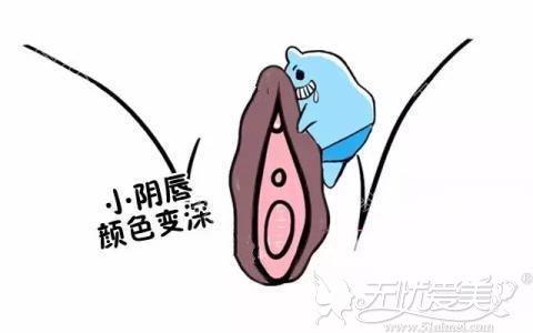 晨意帮忙丨女子做“粉嫩术”无效要退款_整形机构：效果因人而异(女士門診部機構)