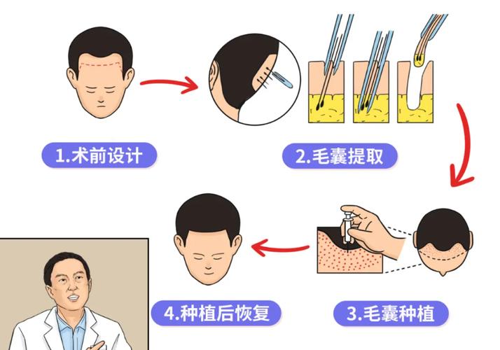 颜值即正义？这几个暴利行业_人人都能做(植發正義能做)