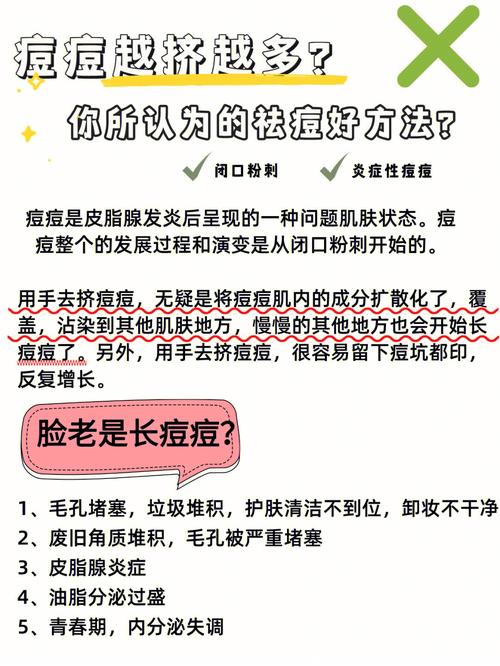 祛痘总是见效很慢？有没有分分钟见效的办法？(很慢祛痘辦法)