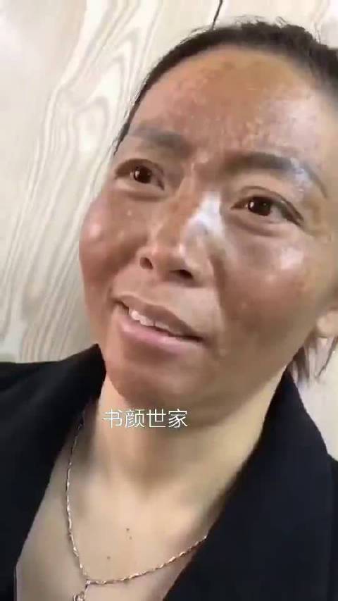 美容变成“大花脸” 漯河市民巧用微信对话来维权(女士老板美容)